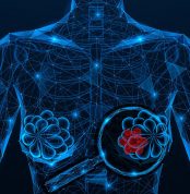 Detection,Of,Breast,Cancer.,A,Tumor,Under,A,Magnifying,Glass.