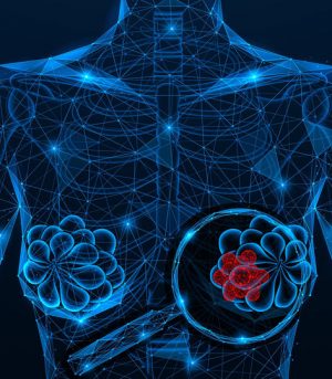 Detection,Of,Breast,Cancer.,A,Tumor,Under,A,Magnifying,Glass.