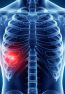 Anatomical,X-ray,Of,Human,Torso,And,Rib,Cage.,Close-up,On